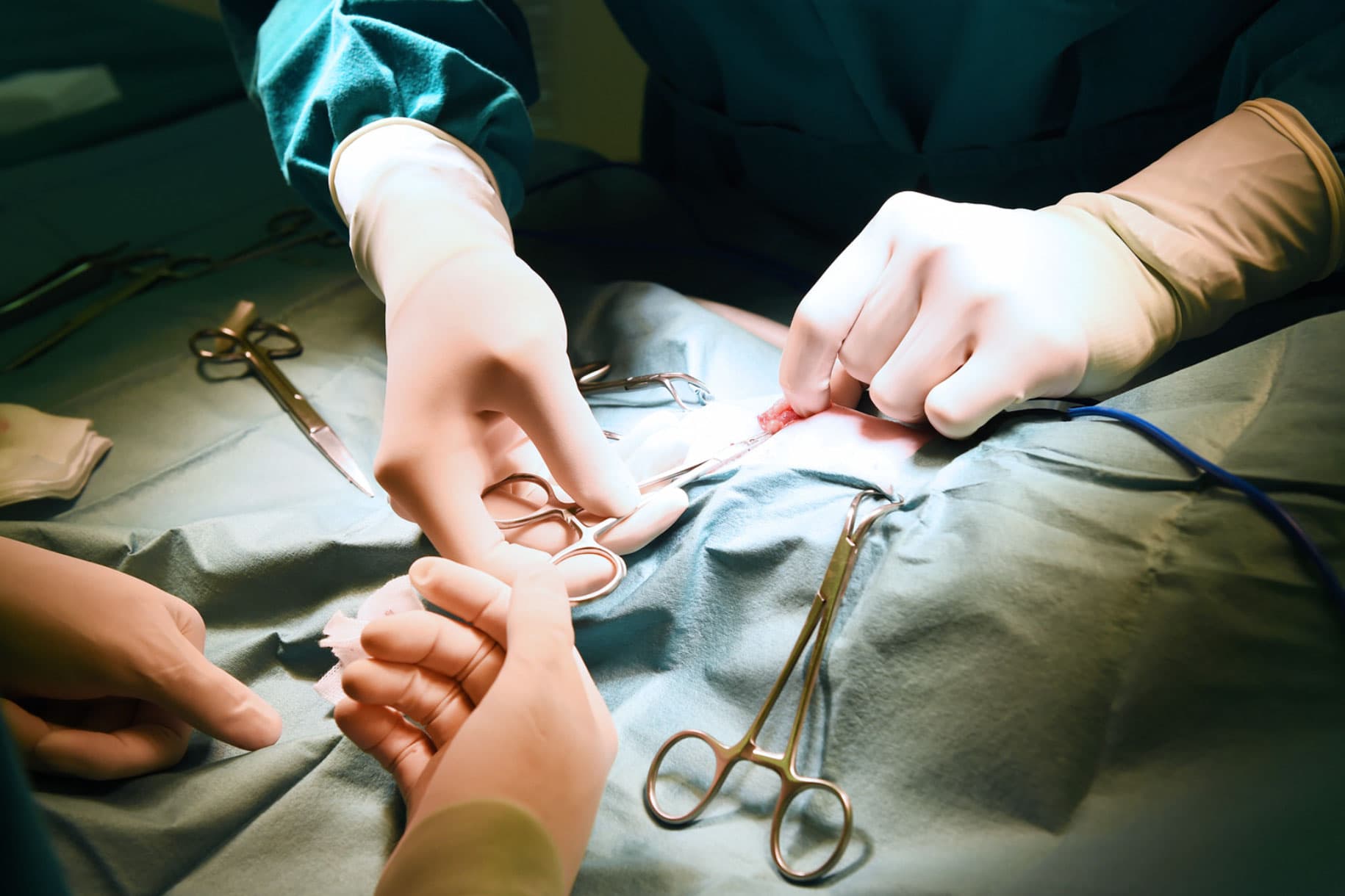 Neurosurgical robotics in the operating room